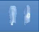 Anatomical Closed Contour Matrix No. 1.953 for Diastema Closure