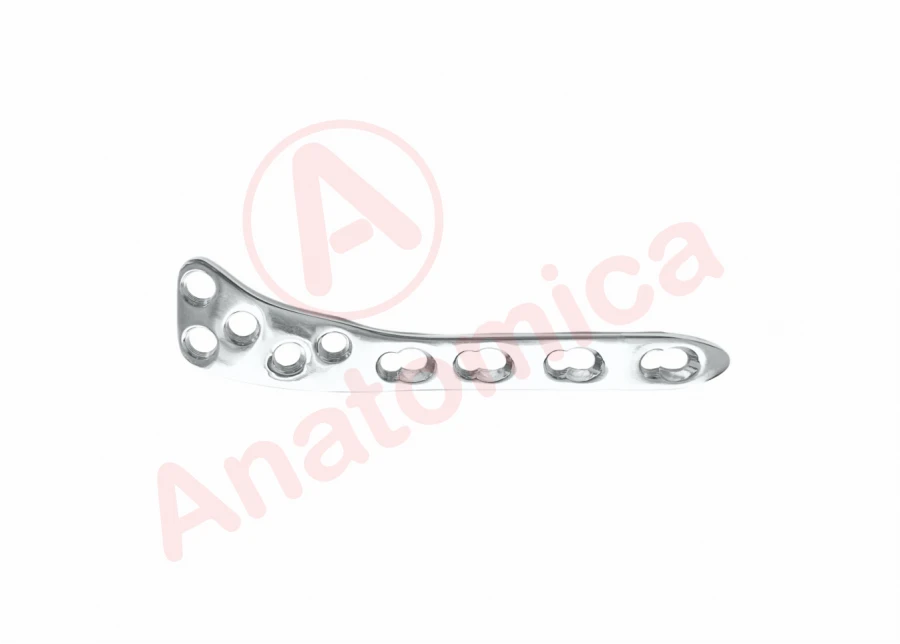 Tibial Plateau Support Plate with Angular Stability for Large Tibia Bone