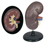 Enlarged Kidney Model (3:1) U4005 / 14005