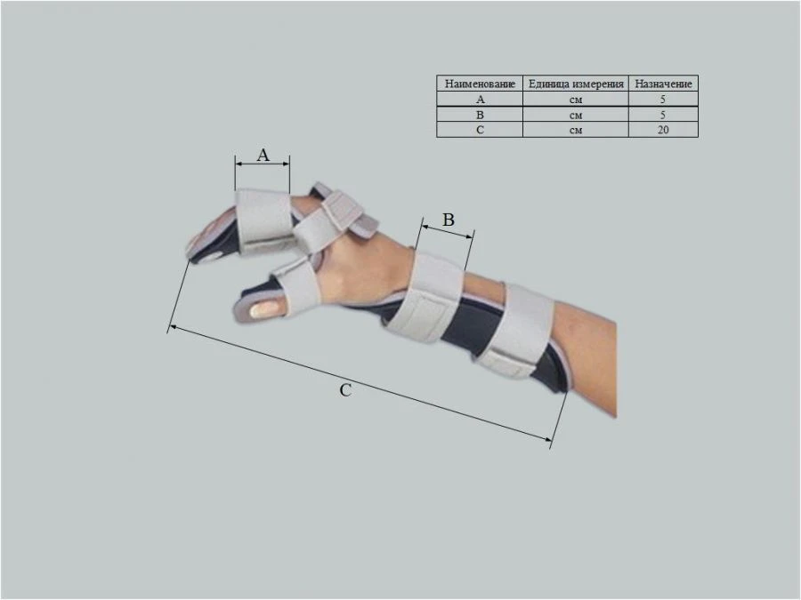 Custom Wrist Joint Orthosis with Metal Frame