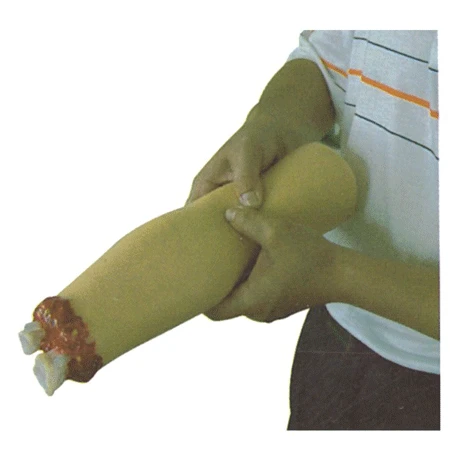 Life-size Amputation Trauma Hand Model H2008