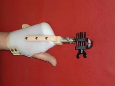 Prosthetic Hand PK9-70-R for Partial and Total Amputation