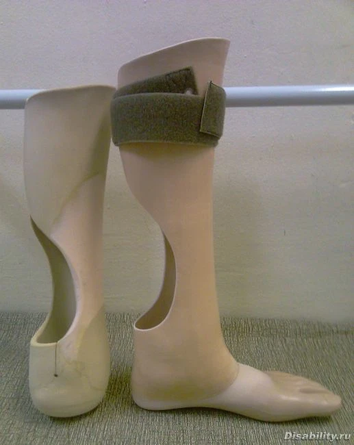 Custom-Made Modular Foot Prosthesis with Individual Casting
