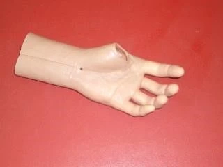 Cosmetic Hand Prosthesis for Partial Hand Amputation PV-KK