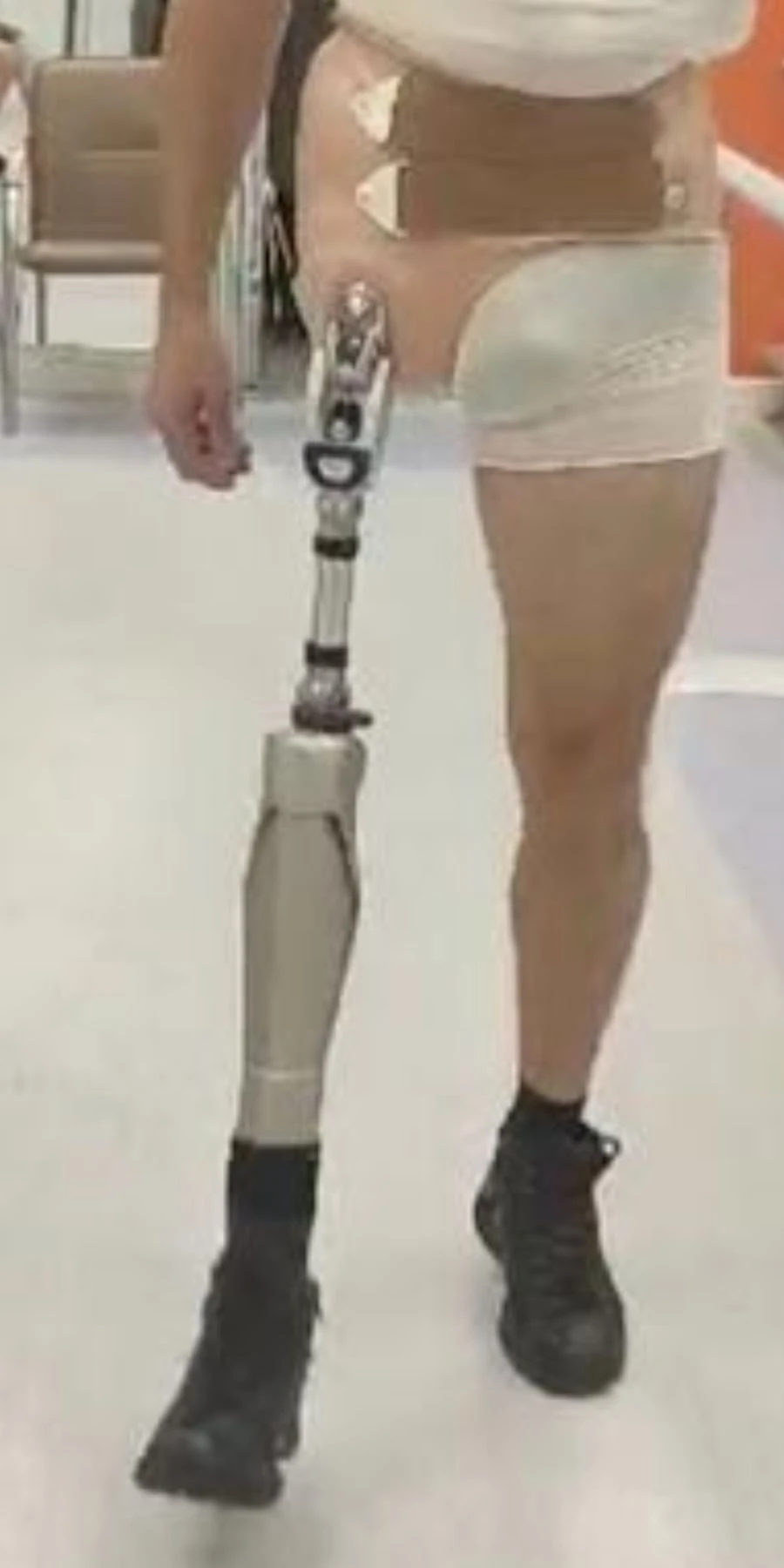 Modular Microprocessor-Controlled Hip Disarticulation Prosthesis PN8-OB-E