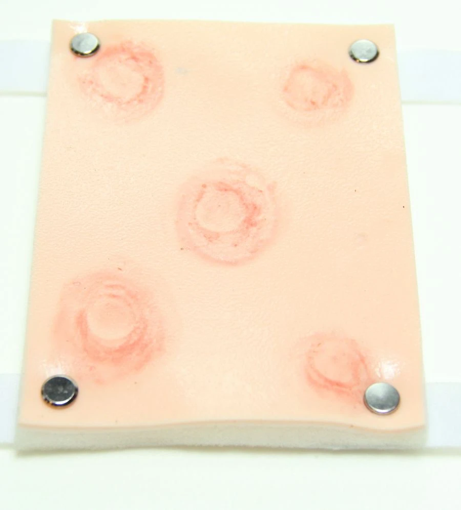 Skin Disease Modules (Set of 5) for Training - ROST-MKZ-5