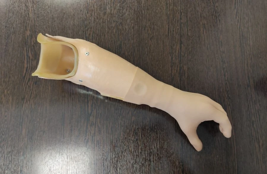 External Energy Source Forearm Prosthesis