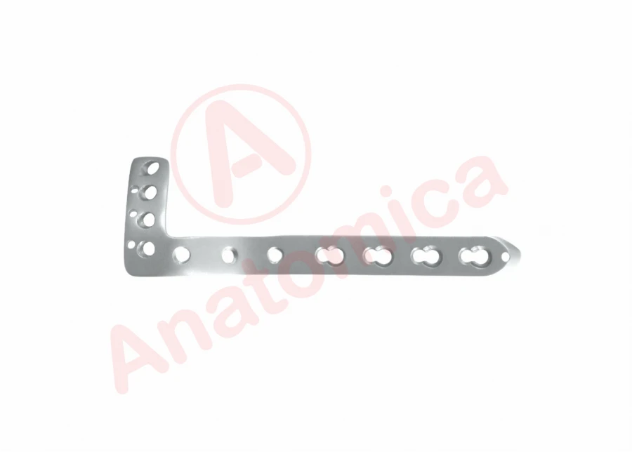 L-Shaped Tibial Plate with Angular Stability and Limited Contact