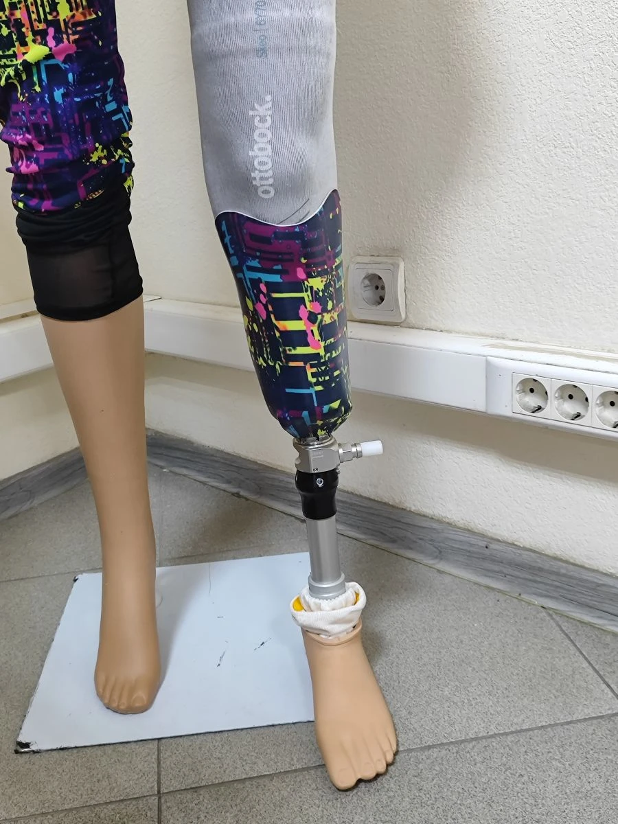Modular Lower Leg Prosthesis for Congenital Limb Deficiency