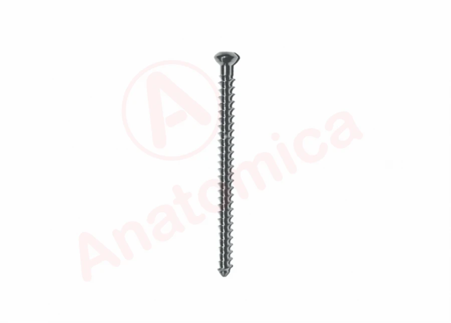 Solid Threaded Spongy Bone Screw for Bone Fracture Fixation