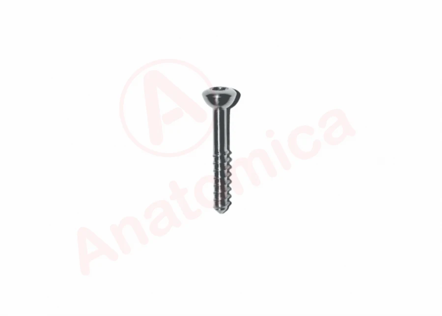 Rod Tension Screw for Bone Fracture Fixation