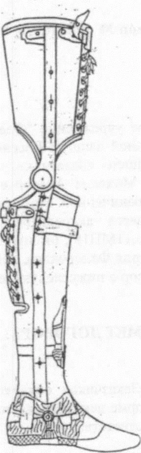 Non-modular Shin Prosthesis for Mobility and Aesthetic Restoration