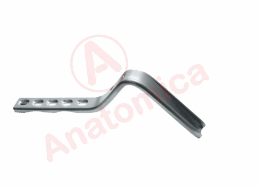 120° Angular Plate with Limited Contact for Bone Fracture Fixation