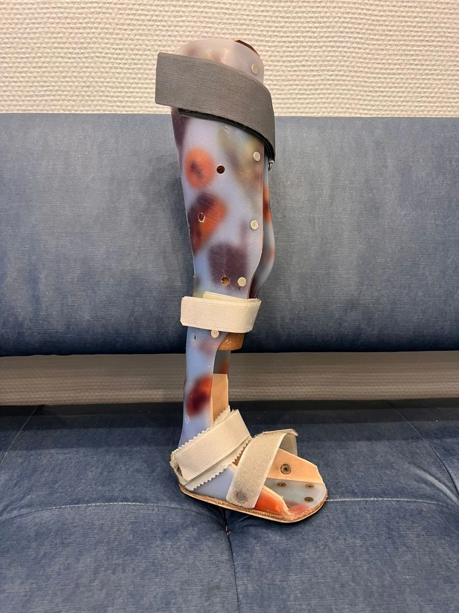 Full Leg Brace for Stabilization and Correction