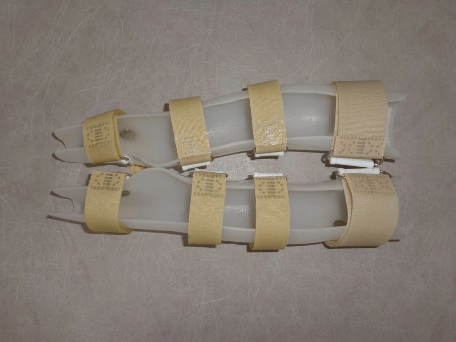 TR2 Forearm Orthosis Custom-Molded Thermoplastic Support