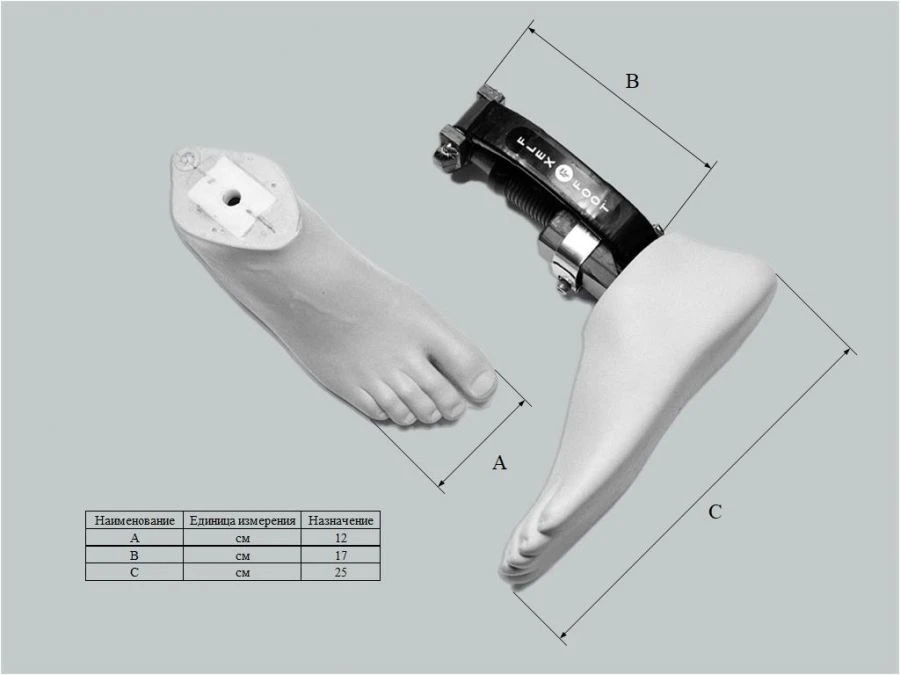 Custom Foot Prosthesis with Modular Metal Structure