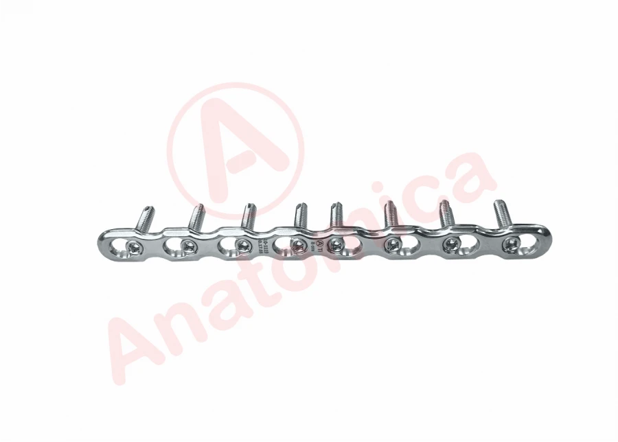 Angular Stability Reconstruction Plate for Bone Fracture Fixation