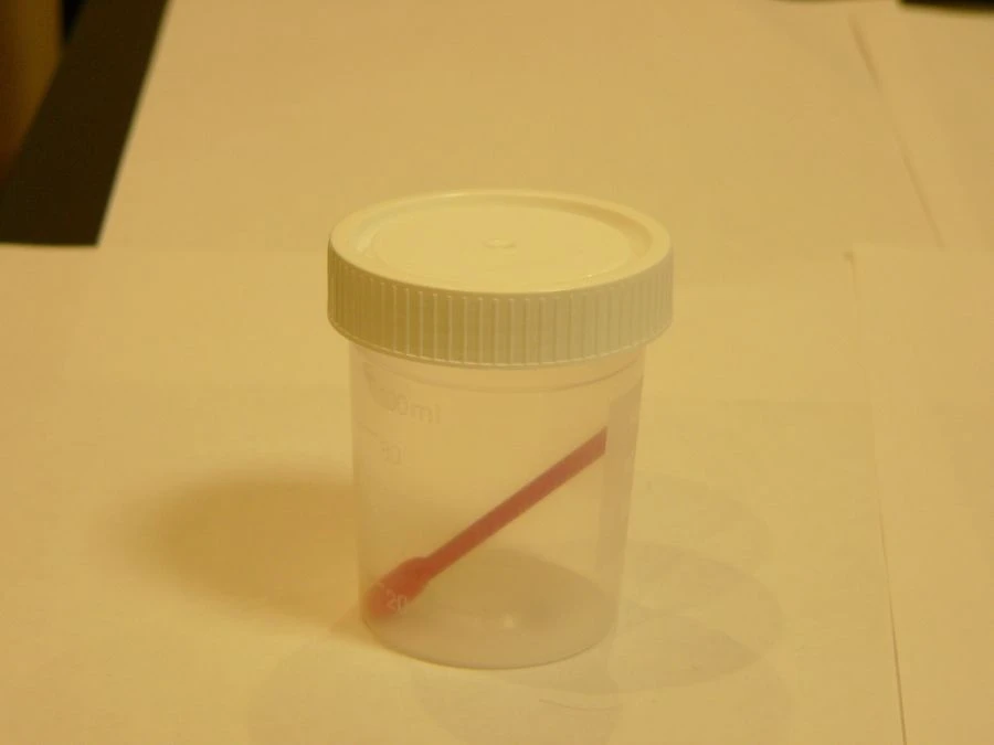 Disposable Sterile Polymer Container for Biological Samples 100ml with Spoon - KOP