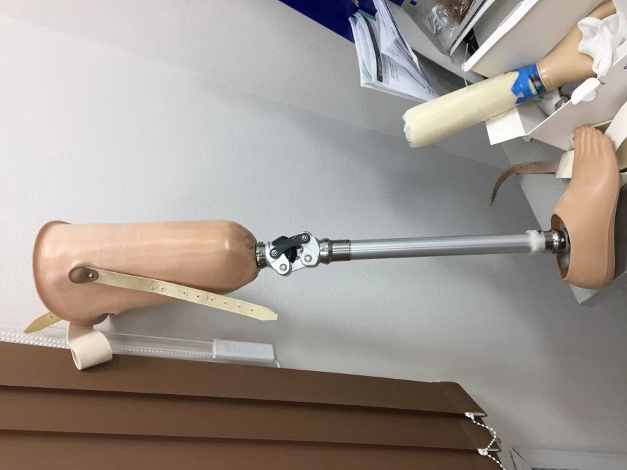 Non- Modular Hip Prosthesis for Lower Limb Amputation