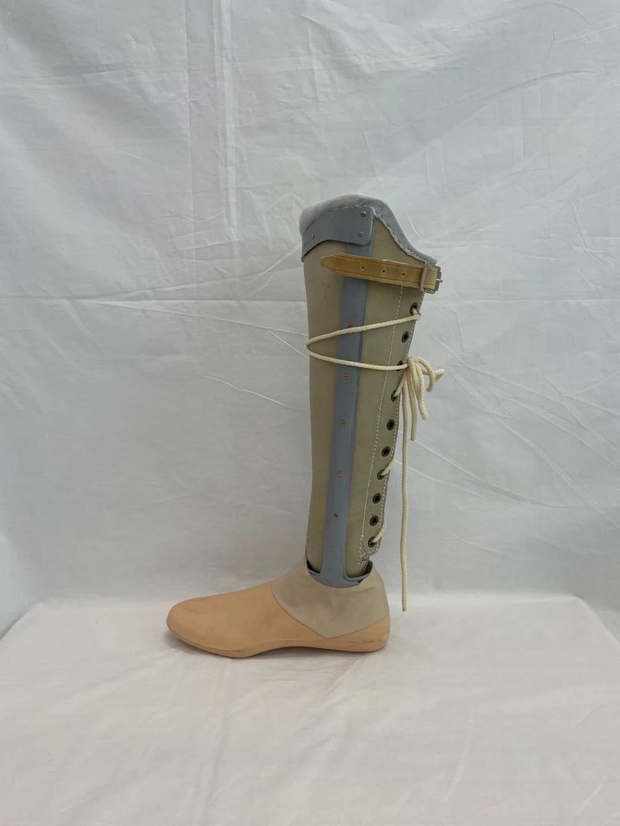 Non-Module Lower Leg Prosthesis for Congenital Underdevelopment