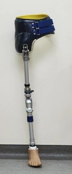 Modular Prosthesis for Hip Disarticulation