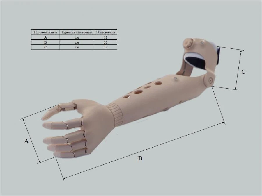 Microprocessor-Controlled Hand Prosthesis for Partial Hand Amputation