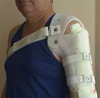 Orthopedic Shoulder Joint Device for Upper/Lower Limbs