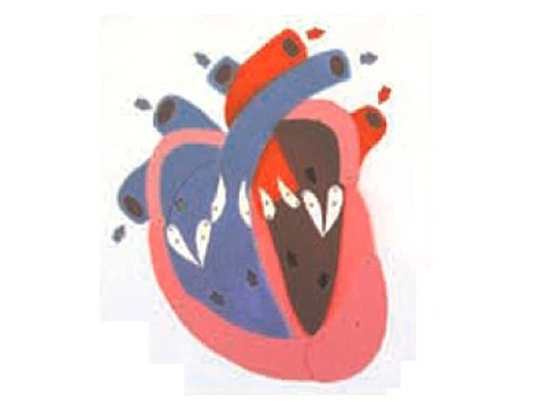 Heart Systole and Diastole Demonstration Model 16015