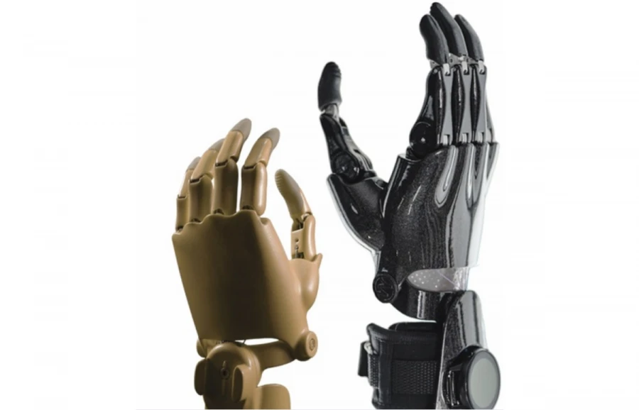 Active Hand Prosthesis for Partial Hand Amputation