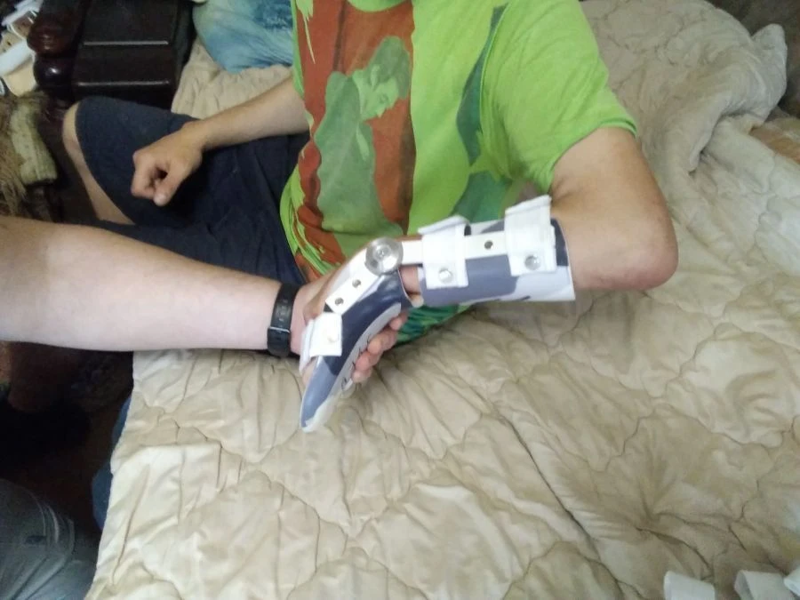 Orthopedic Wrist and Hand Joint Devices for Stabilization