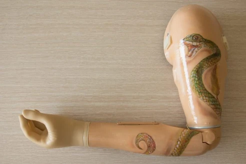 Microprocessor-Controlled Arm Prosthesis Model MCP-2023