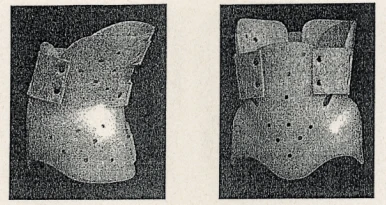 Lumbar-Sacral Rigid Stabilization Corset KР0-273