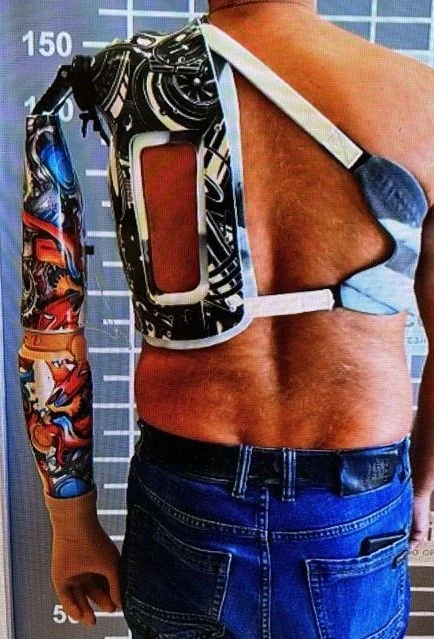 Active Shoulder Prosthesis (Traction Type)