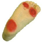 Diabetic Foot Model, Art. S19