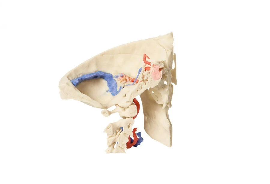 Advanced Temporal Bone Model for Anatomy Study, 11119