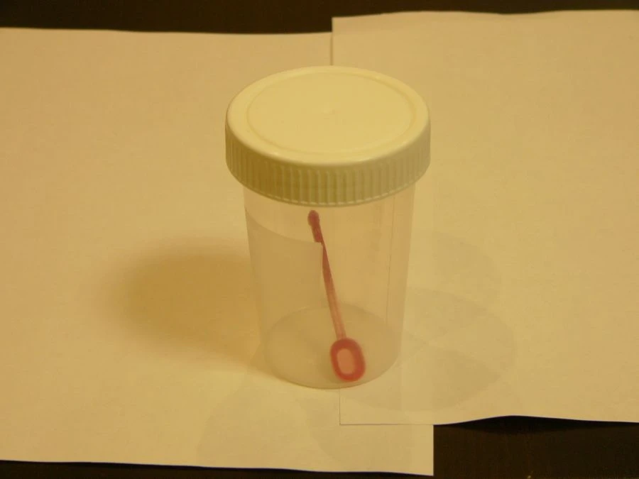 Sterile Disposable Polymer Container for Biological Samples 150ml with Spoon - KOP