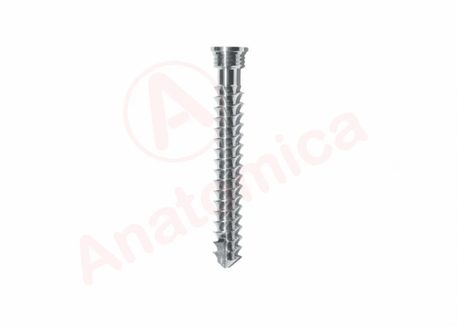 Spongy Screw with Cylindrical Thread for Bone Fixation