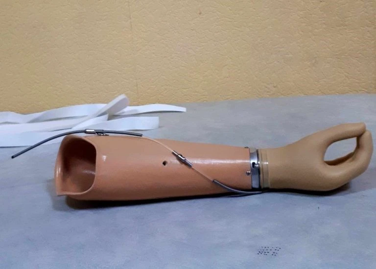 Active Forearm Prosthesis - Universal Model
