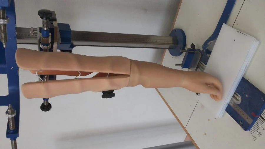 Active Forearm Prosthesis PР2-А.1