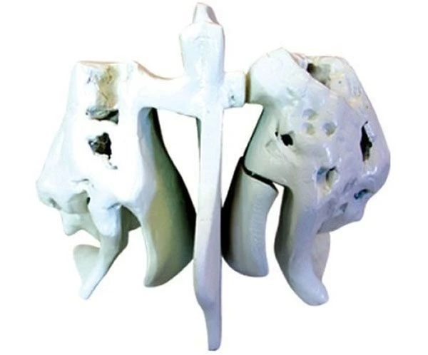 Enlarged Ethmoid Bone Model with Stand, 11121