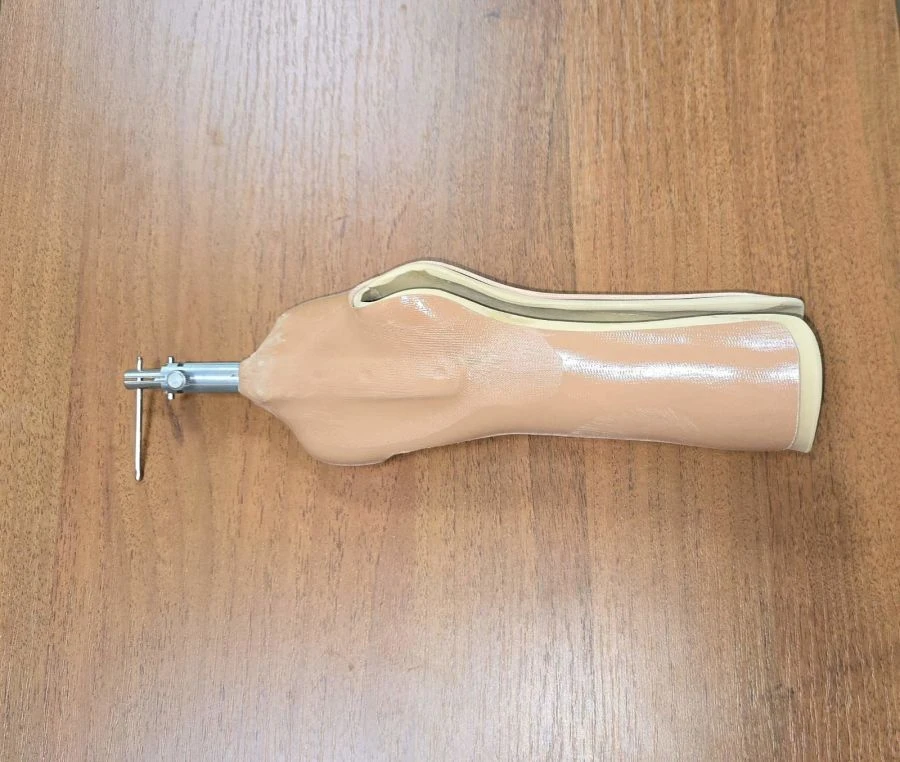 Functional Hand Prosthesis for Amputation and Partial Hand Loss