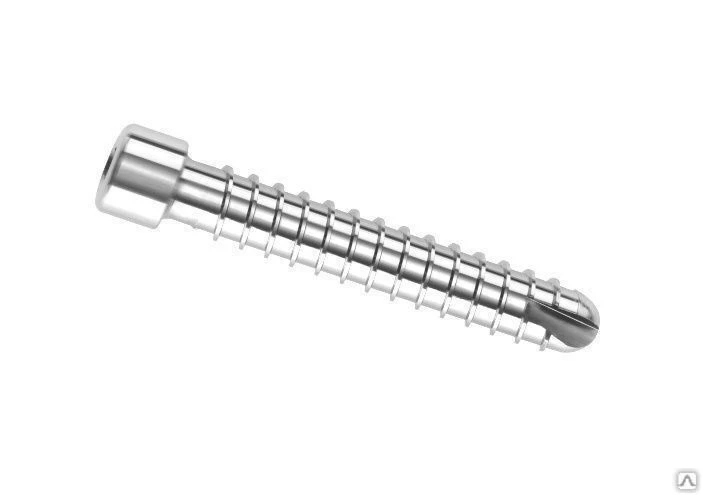 Intramedullary Nail Locking Screw for Femur