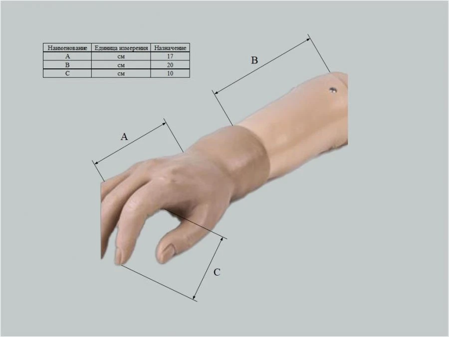 Custom Cosmetic Hand Prosthesis for Partial Hand Amputation