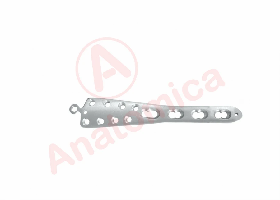 Medial Tension Plate for Tibia with Angled Stability