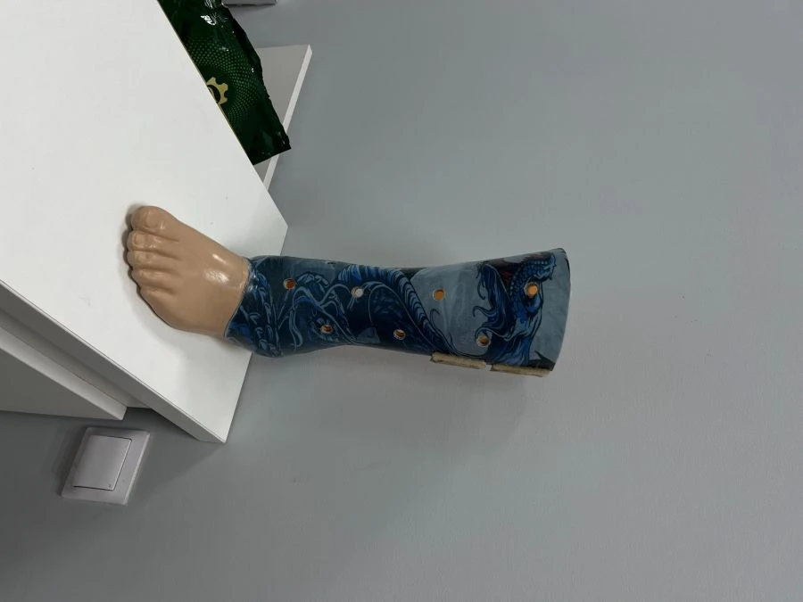 Custom Foot Prosthesis 8-07-01