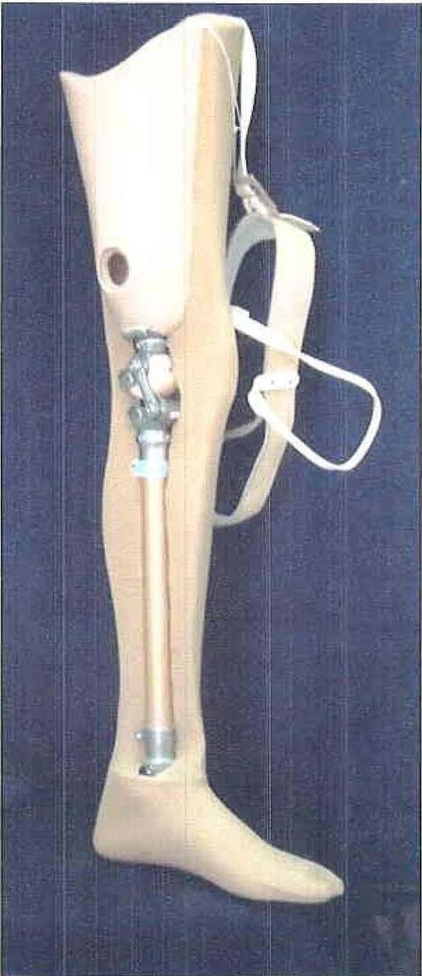 Modular Hip Prosthesis for Congenital Underdevelopment PN6-03-OK