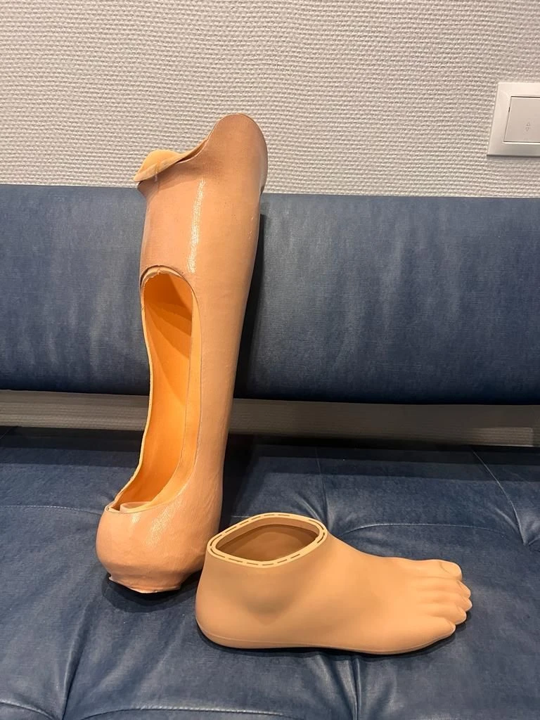 Foot Prosthesis - Customizable Trial Socket and Permanent Sleeve