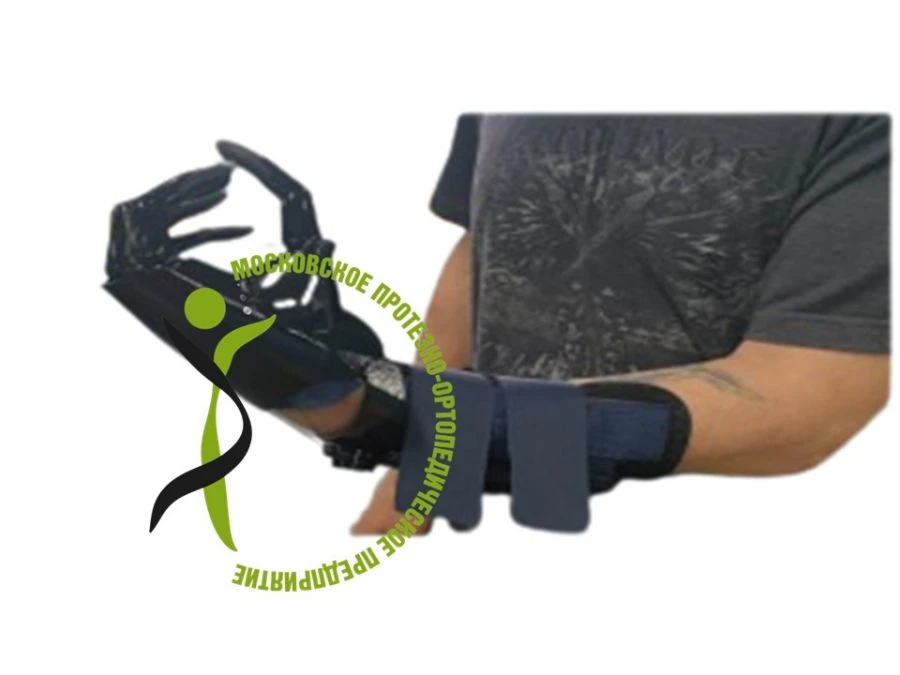 Active Hand Prosthesis for Partial Hand Amputation, Model PR0-22