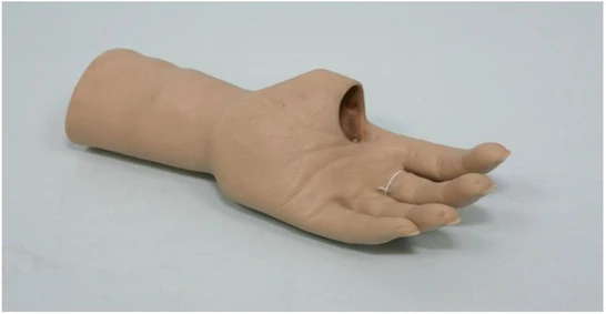 Cosmetic Hand Prosthesis for Amputation Recovery