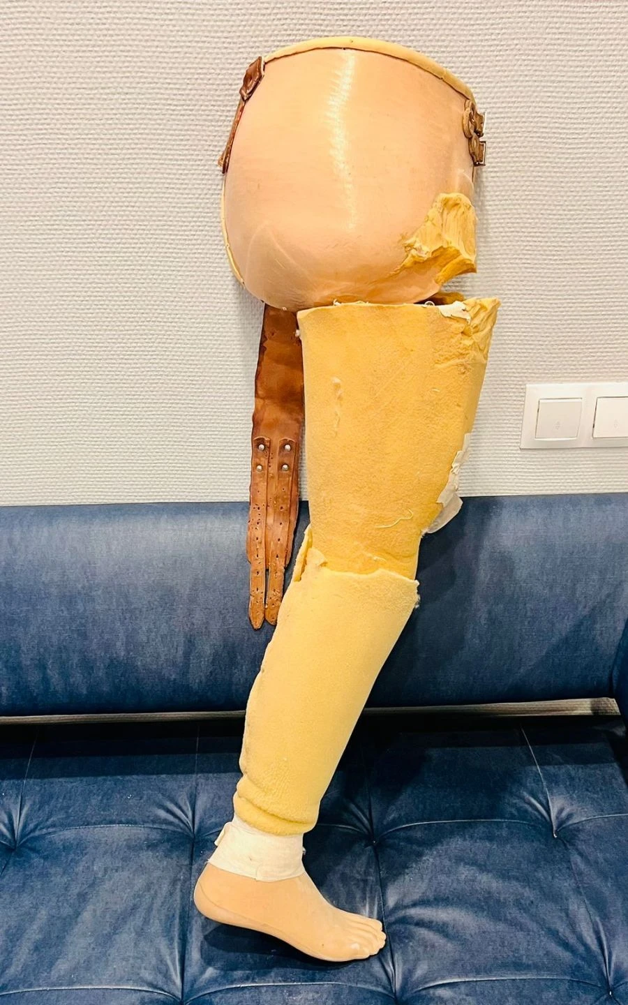 Modular Prosthesis for Hip Disarticulation